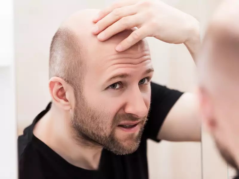 Ways to Treat Hair in men